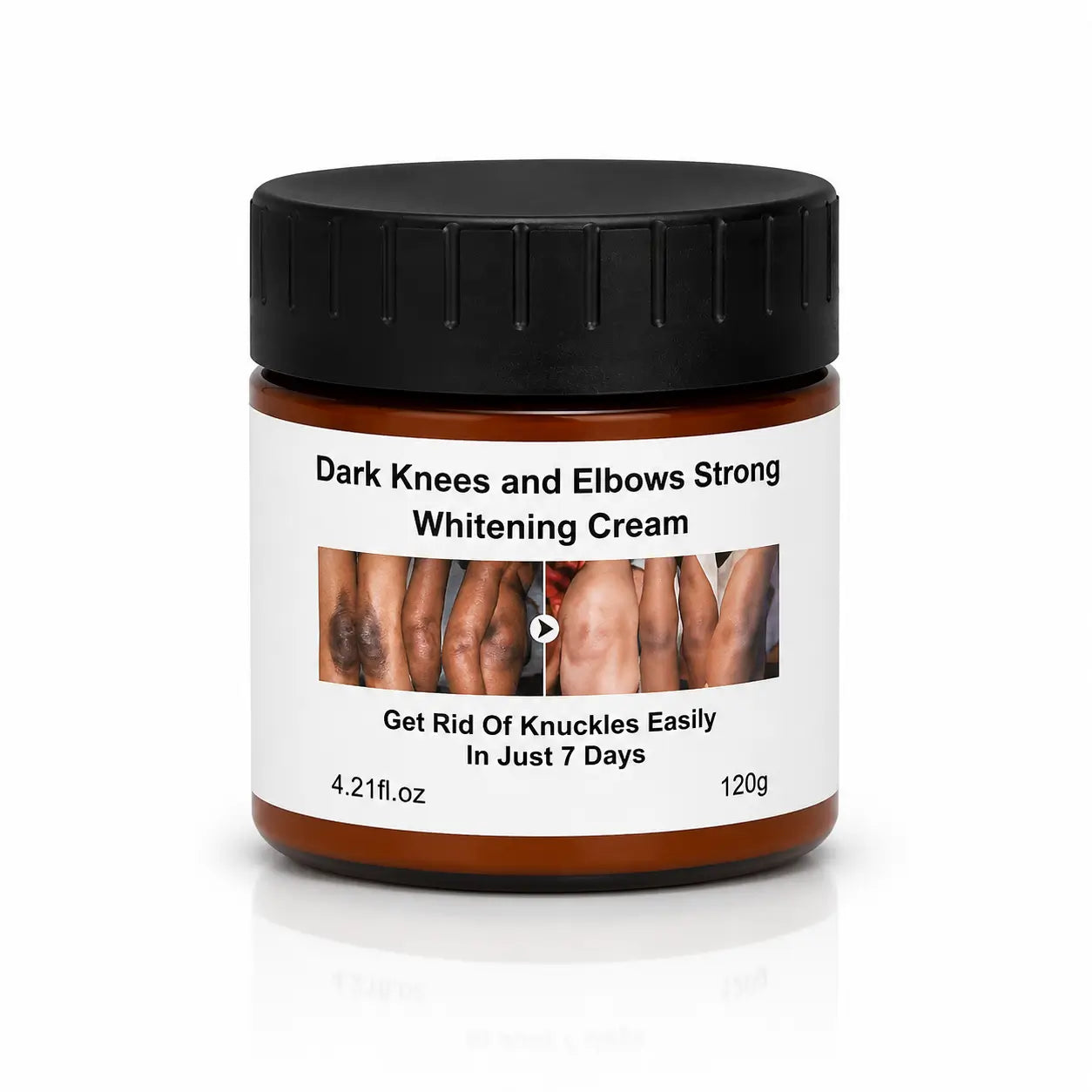 MOOYAM Dark Knees and Elbows Strong Whitening Cream in an amber jar with a black lid, featuring before-and-after skin images on the label.